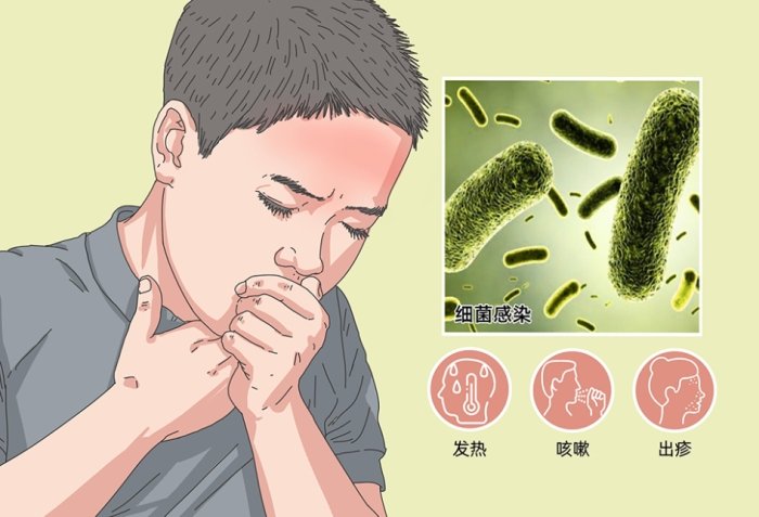 細菌感染