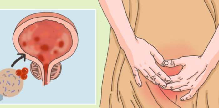 感染與血糖關係